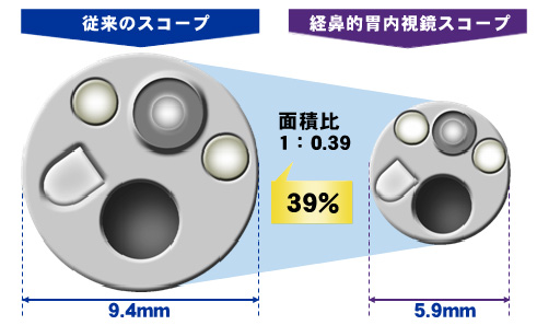 口からと鼻からで胃カメラのサイズはこんなに違う